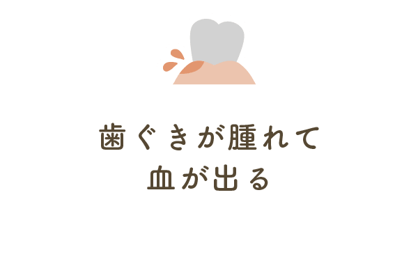 歯ぐきが腫れて血が出る