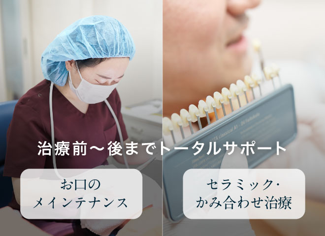 「お口のメインテナンス」「セラミック・かみ合わせ治療」治療前〜後までトータルサポート
