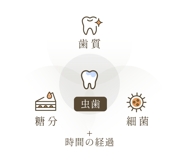 虫歯の原因は「歯質」「糖分」「細菌」と時間の経過