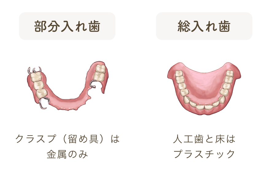 部分入れ歯：クラスプ（留め具）は金属のみ、総入れ歯：人工歯と床はプラスチック