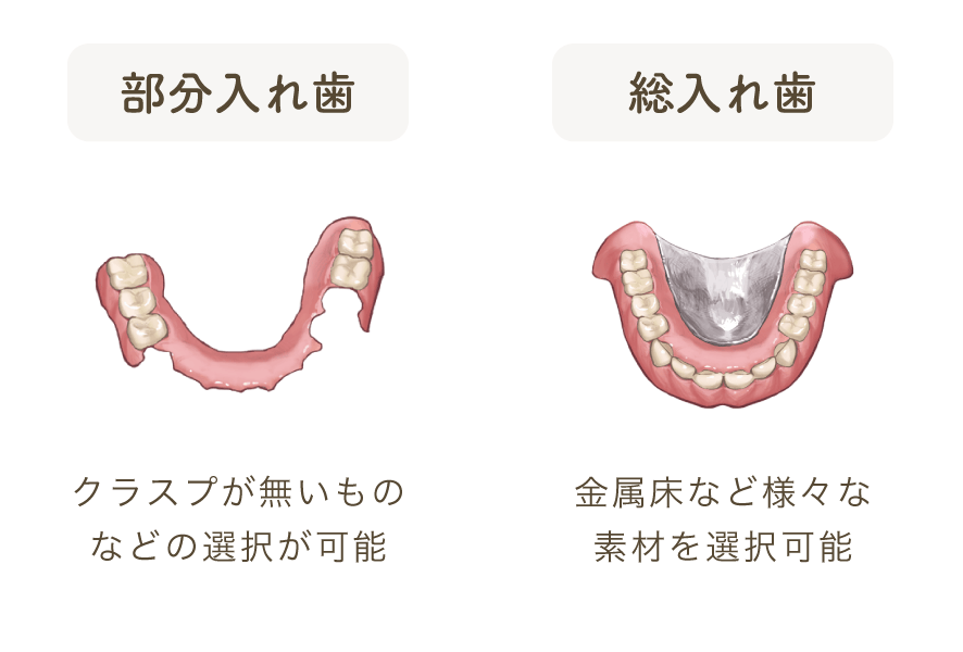 部分入れ歯：クラスプが無いものなどの選択が可能、総入れ歯：金属床など様々な素材を選択可能