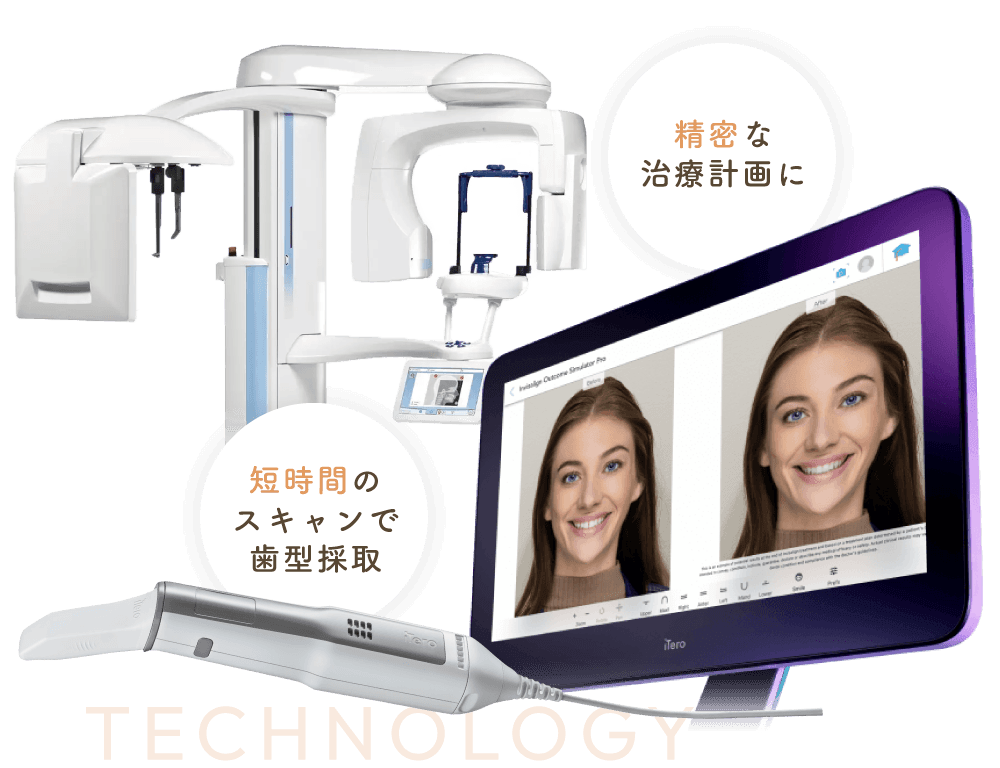 精密な治療計画に/短時間のスキャンで歯型採取