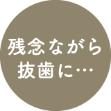 残念ながら抜歯に…