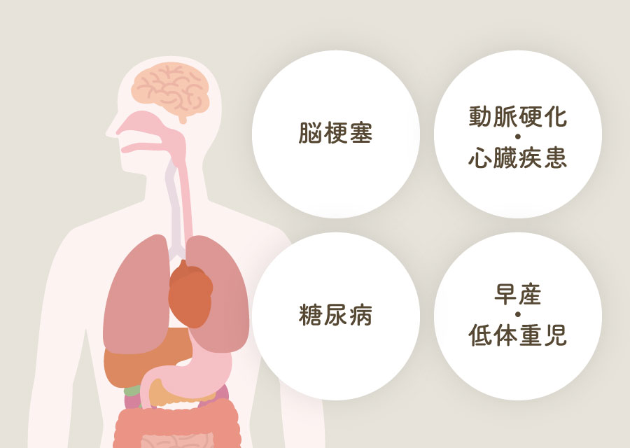 「脳梗塞」「動脈硬化・心臓疾患」「糖尿病」「早産・低体重児」
