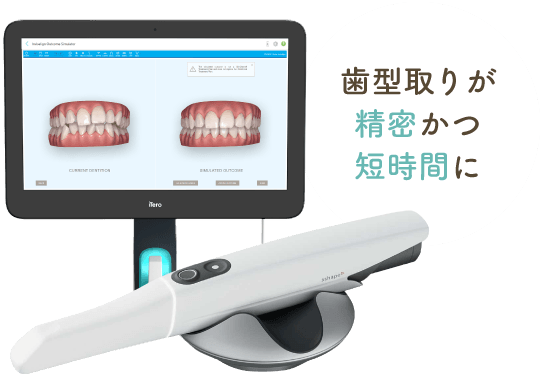 歯型取りが精密かつ短時間に